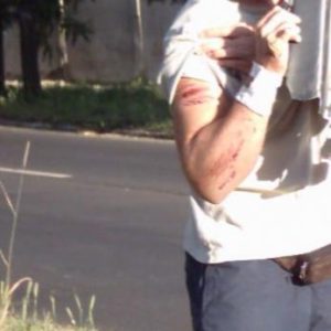 Kollégánkat durva balesetben megvédte a LAZER (LZR) bukósisak